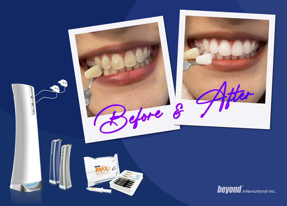 Image is not available